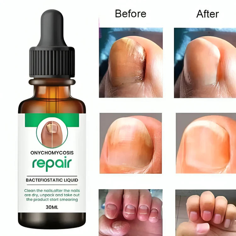 Nail Growth & Repair Serum (pack of 2)