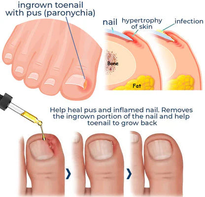 Nail Growth & Repair Serum (pack of 2)